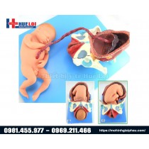 Mô hình ngôi thai và các giai đoạn của quá trình sinh nở